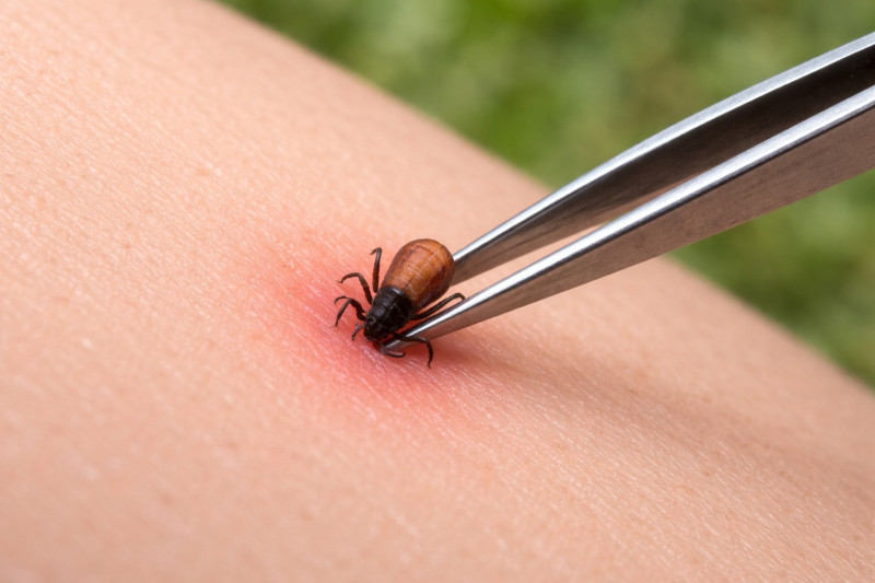 [/userfiles/files/premahvane-na-karlezh-s-pinceta-pravilno.jpg]